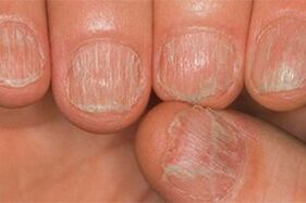 The lesion of the sponge