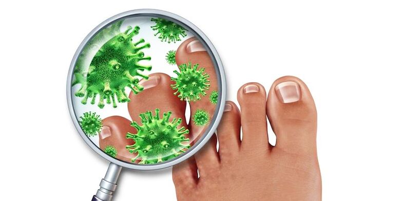 Nails infected with a sponge