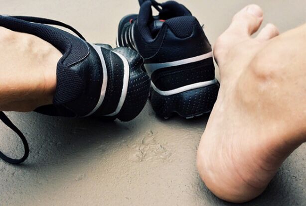 The reasons for the appearance of mycosis of the legs