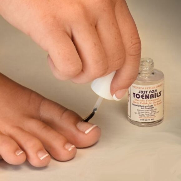 fungal varnish is used in the early stages of nail fungus infection